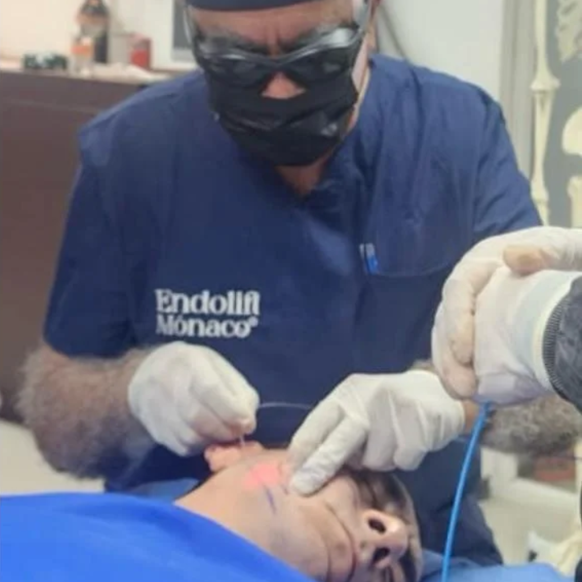 Endolift: Lifting facial no invasivo en Cuernavaca