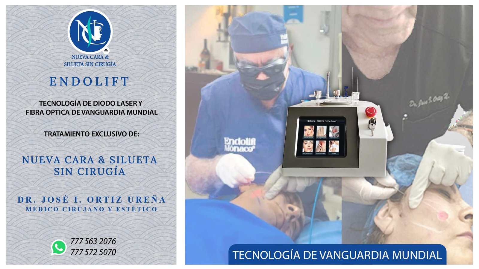 Tratamiento Endolift en Cuernavaca | Nueva Cara & Silueta sin Cirugía con el Dr. José Ignacio Ortiz